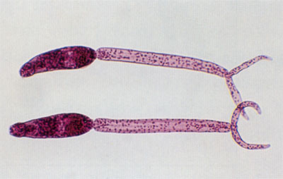 Schistosoma-cercarier.jpg