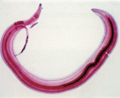 Schistosoma-maskpar.jpg